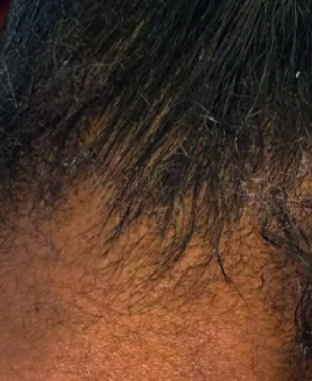 After 3-5_Mesa de trabajo 1